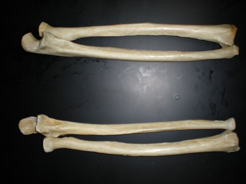 Muscle attachemnts for the ulna and radius Quiz - By KeeperHes